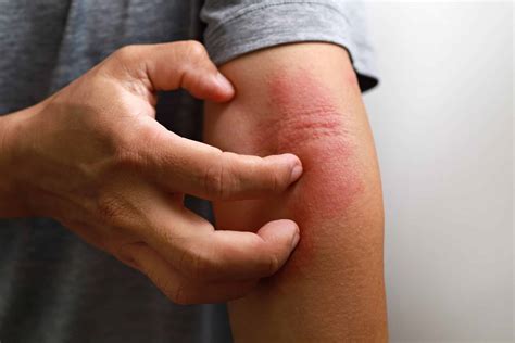 Define Dermatology Aesthetics