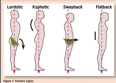 posture physiopedia