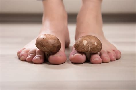 Foot Fungus - South Jersey Podiatrist | South Jersey Foot Doctor | Dr. Diana Tsombaris, DPM