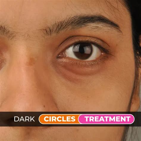 dot clinics aesthetic hair transplant ed multan lahore