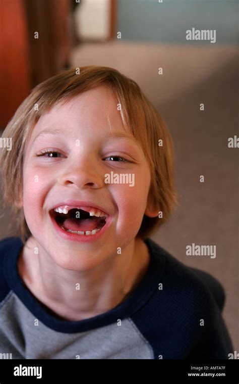 Missing my two front teeth hi-res stock photography and images - Alamy