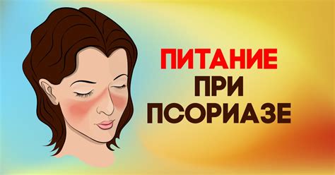 Диета при псориазе - Со Вкусом