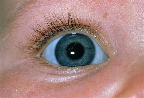white  eye blue tint baby captions profile