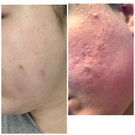 InfluencerGoneWild's Before & After: The Ultimate Transformation Guide. Image 17