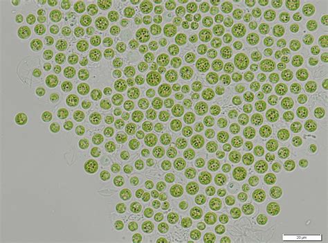CyanoRO - a page dedicated to Romanian Cyanobacteria : Microcystis ...