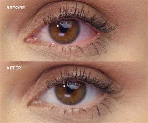 How LUMIFY® Redness Reliever Eye Drops Work Differently