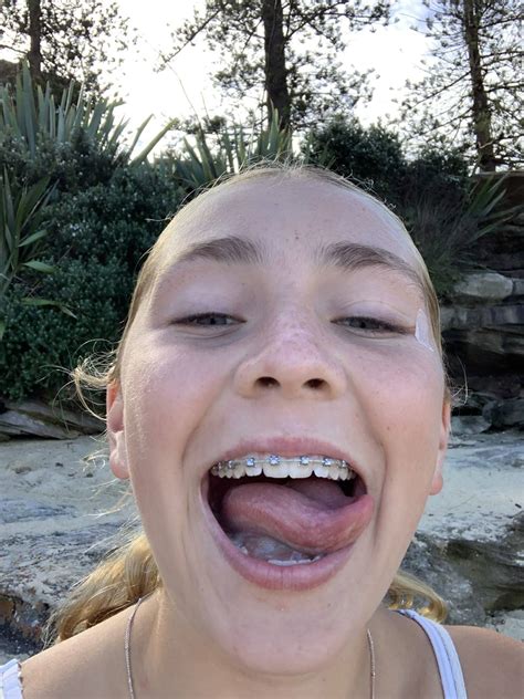 @bracefacebops on Tumblr