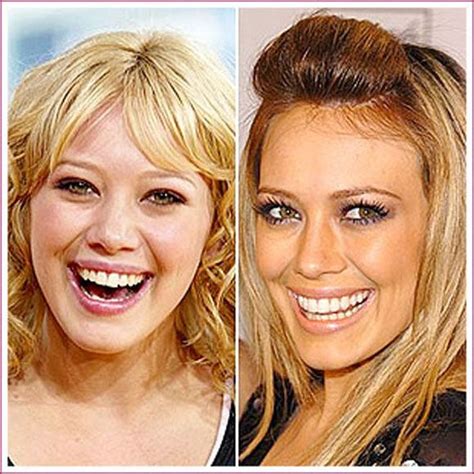 Phun Forum Celebrity Extra: The Truth About Celebrity Plastic Surgery! - 5ugb7yy