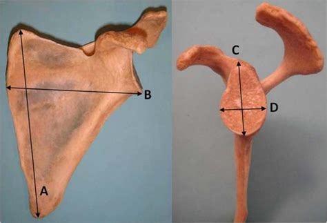photograph   left scapula anterior view  major longitudinal axis
