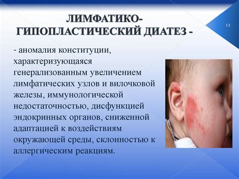 Аномалии конституции (диатезы) - презентация онлайн