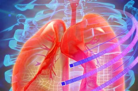 Dlung: A novel method for lung image registration