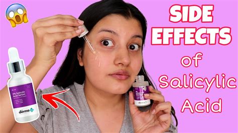 SIDE EFFECTS of Salicylic Acid | Is Salicylic Acid Safe To Use For ACNE ...