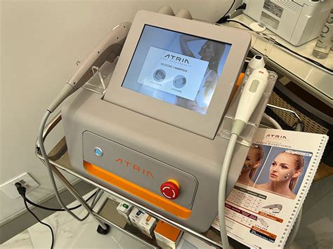 Atria Ultrassom Antes E Depois - Átria: antes e depois do procedimento de estímulo de colágeno