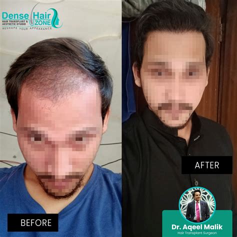 Dense Hair Zone - 📸 Prepare to be amazed by the...