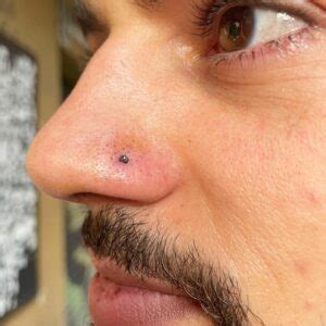 how to fix sinking nose piercing