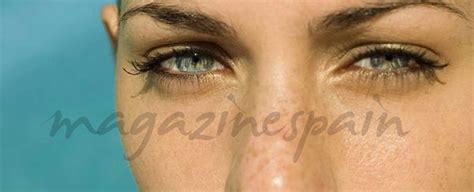 manchas cutaneas  cada tipo su solucion magazinespaincom