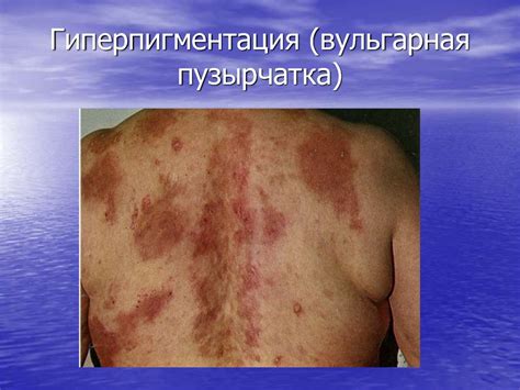Введение в дерматовенерологию. Значение дерматовенерологии для врачей ...
