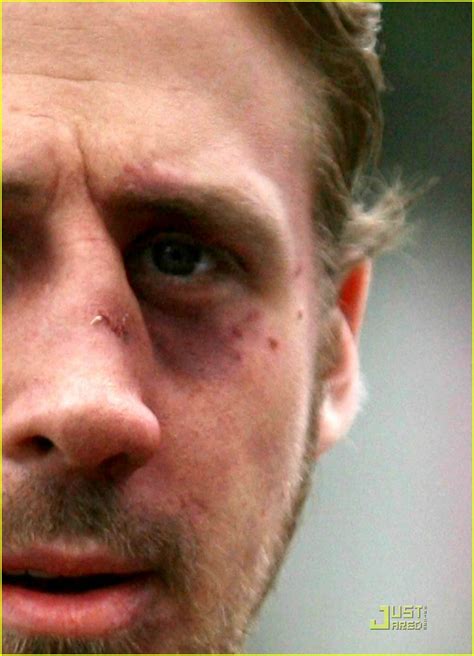 Ryan Gosling Gets A Black Eye: Photo 1906921 | Ryan Gosling Photos ...