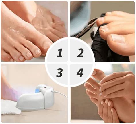 Welnax BioClear® | Official Website | Best Nail Fungus Device