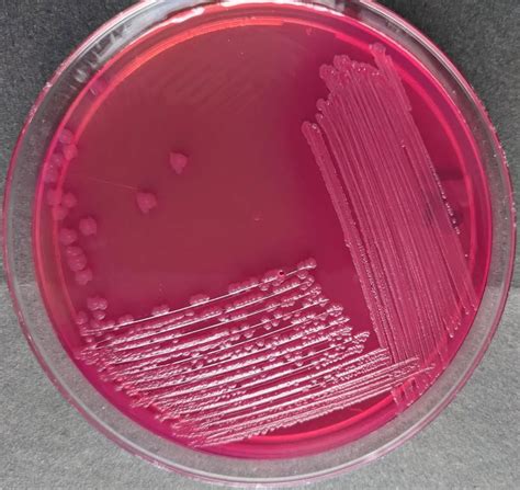 MacConkey Agar: Composition, Uses, Colony Characteristics