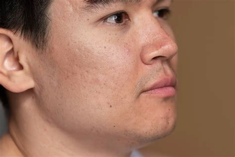 menghilangkan kulit bertekstur  benar