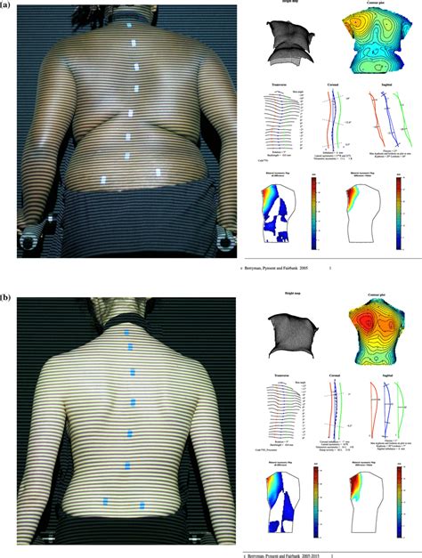 isis image  clinical photograph   individual identified