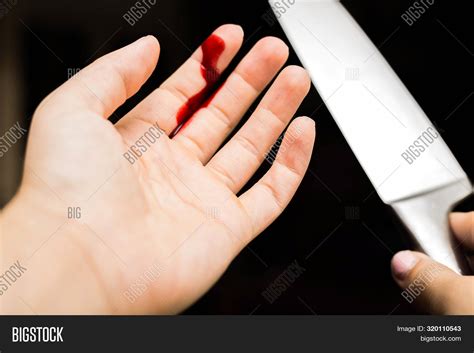 Finger Cut By Knife
