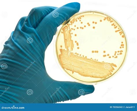 Bacteria Culture Royalty-Free Stock Image | CartoonDealer.com #79116664