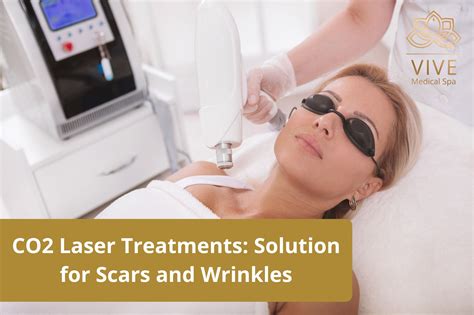 laser treatments solution  scars  wrinkles