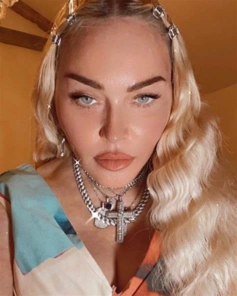 Plastic surgery experts on the work Madonna did to her face