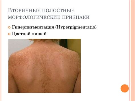 Первичные и вторичные полостные морфологические признаки - online ...