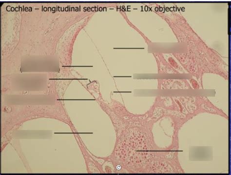 Cochlea histology Diagram | Quizlet