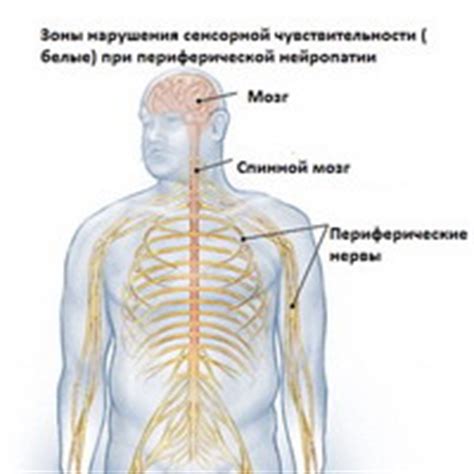 Периферическая нейропатия нерва - лечение, симптомы, причины ...