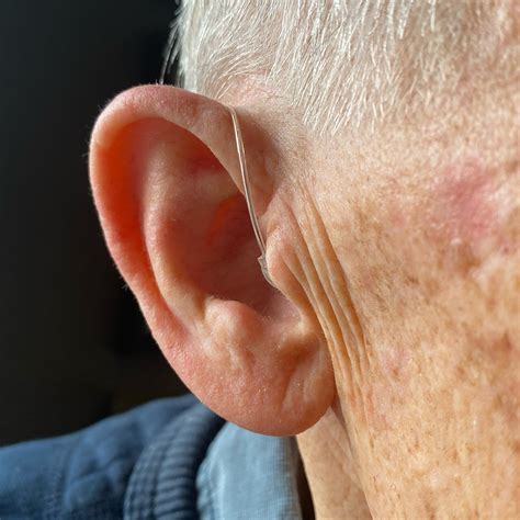 BTE Rechargeable Hearing Aids (Pair) – The Hearing Co.