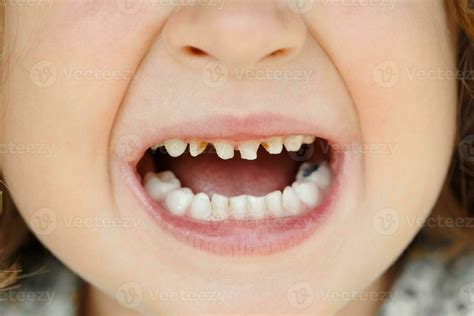 open mouth teeth stock  images  backgrounds