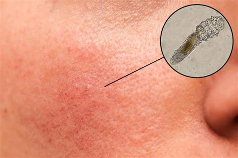 Dermatoloji | Cansu Alakbarov | İzmir