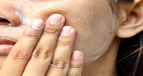 Exfoliate - What Is Exfoliate, How To Do This According To Skin Type