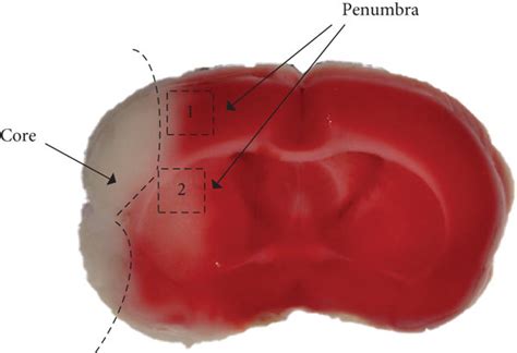 penumbra  infarct core  rats  mcao  penumbra