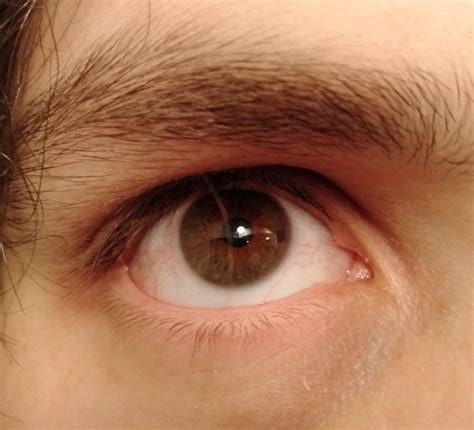 Weird brown spot seem to have appeared on my iris, is it something to
