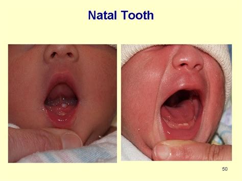 normal newborn care neonatal care  introduction