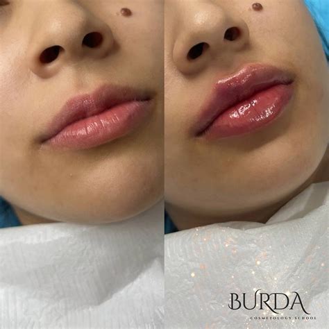 Очень красивая работа ученицы 😍 Процедура увелечение губ 👄