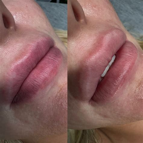 Lip Blush Gone Wrong