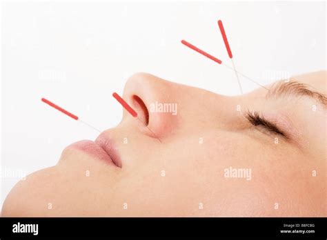 Woman with acupuncture needles in her face Stock Photo - Alamy