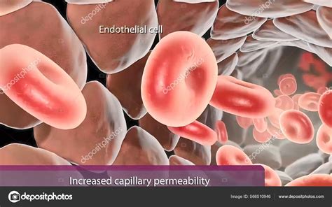 Hydrostatic Pressure Capillaries Increases Production Tissue Fluid Allowing More Water Stock ...