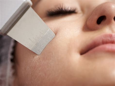 7 Unbelievable Blackhead Removal 2024 Tricks Dermatologists Use (But Don't Tell You!) Image 15