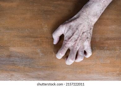 266 Contracture Symptoms Images, Stock Photos & Vectors | Shutterstock
