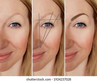 143 Eyebrows Before And After Laminated Images, Stock Photos & Vectors ...