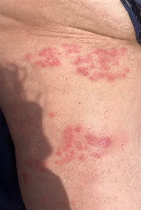 Any idea what could this be? It’s a couple months old, doesn’t