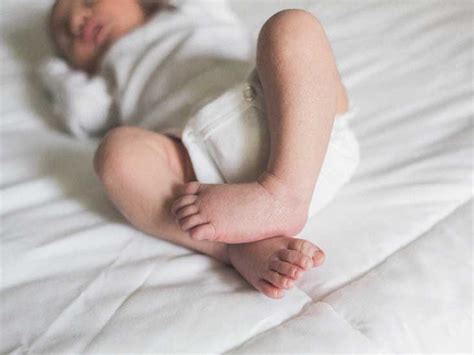 lymphangioma symptoms outlook treatment