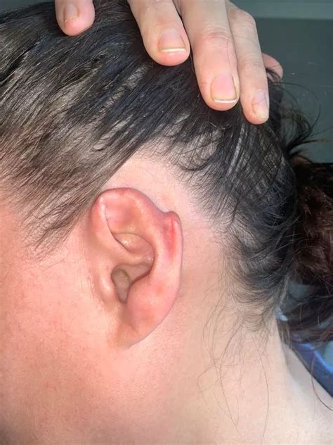 mums ear bitten   left  taxi floor  stepping